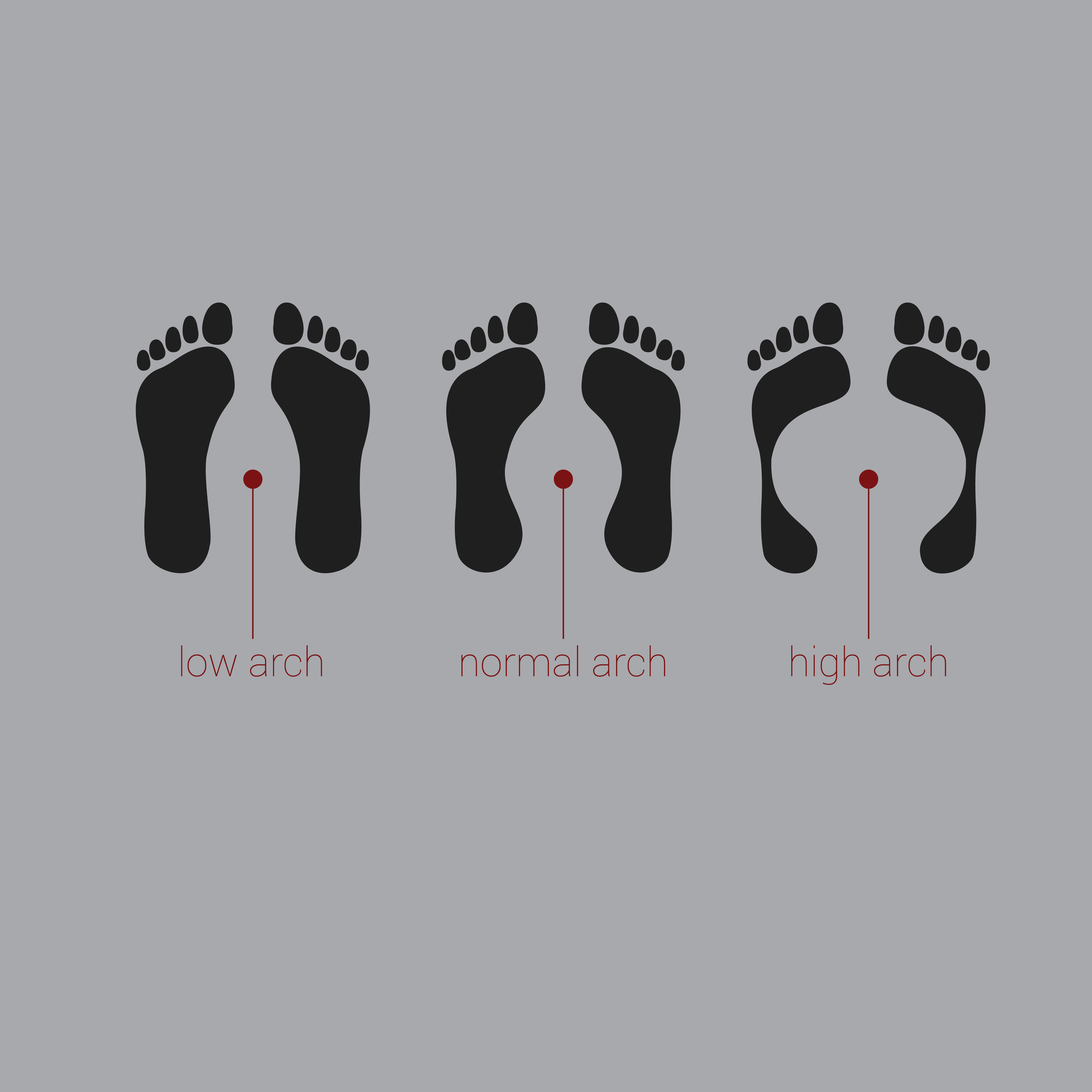 foot arch types